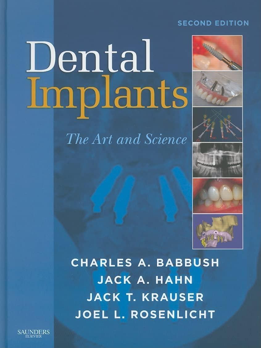 Dental Implants: The Art and Science, 2nd Edition - FULL INSTANT DOWNLOAD | PDF DOCX EPUB