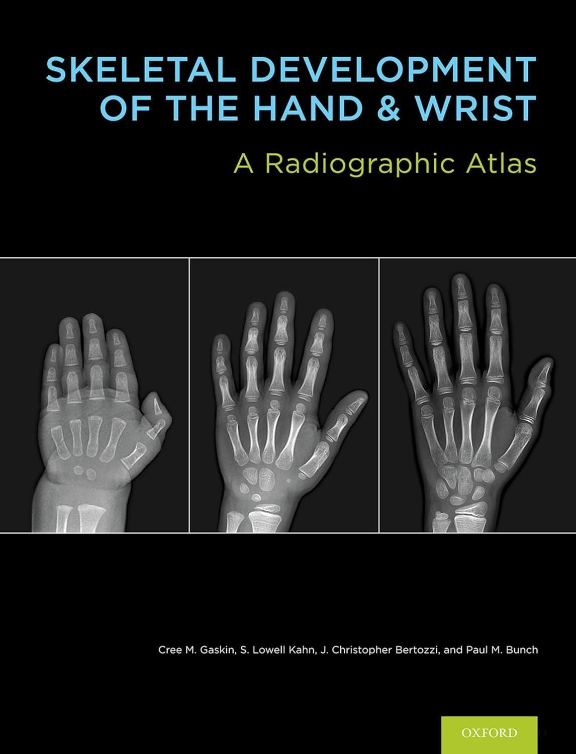 Skeletal Development of the Hand and Wrist: A Radiographic Atlas and Digital Bone Age Companion - FULL INSTANT DOWNLOAD | PDF DOCX EPUB
