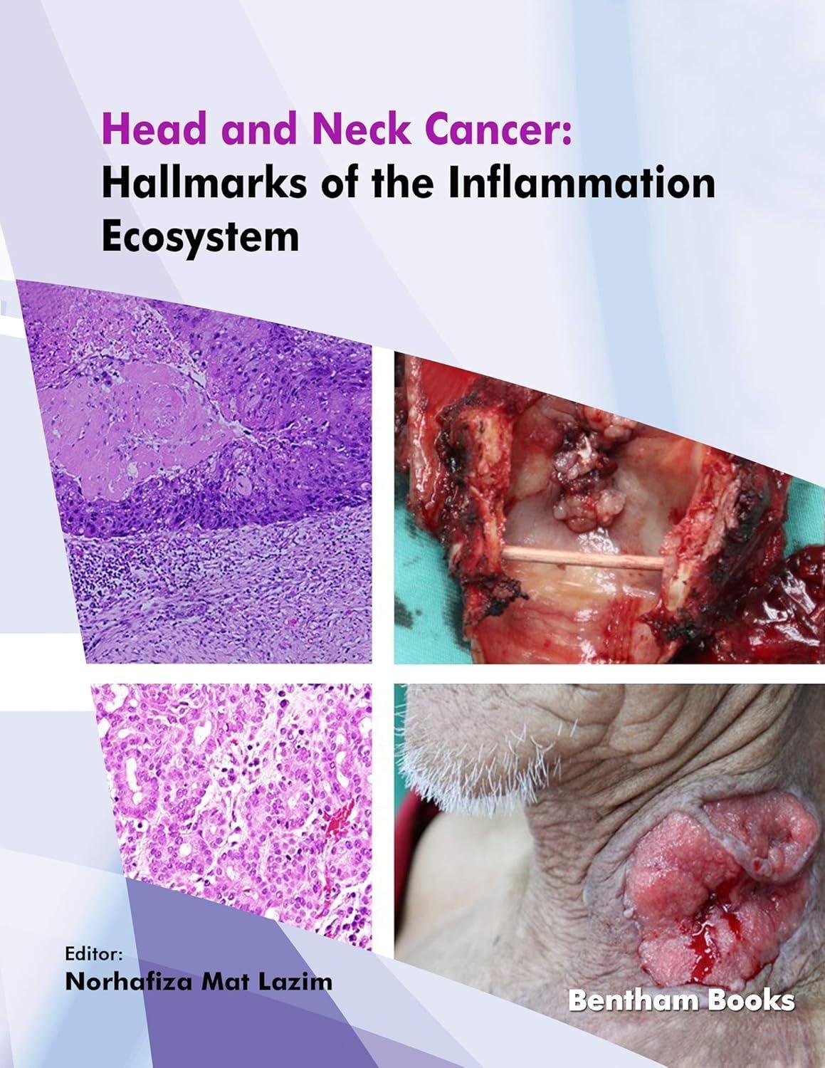 Head and Neck Cancer: Hallmarks of the Inflammation Ecosystem, 1st Edition - FULL INSTANT DOWNLOAD | PDF DOCX EPUB
