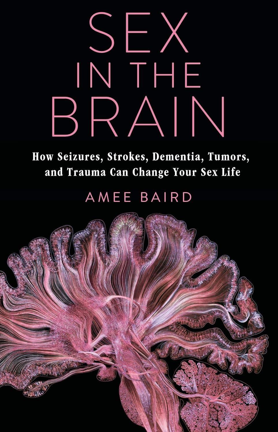 Sex in the Brain: How Seizures, Strokes, Dementia, Tumors, and Trauma Can Change Your Sex Life - FULL INSTANT DOWNLOAD | PDF DOCX EPUB