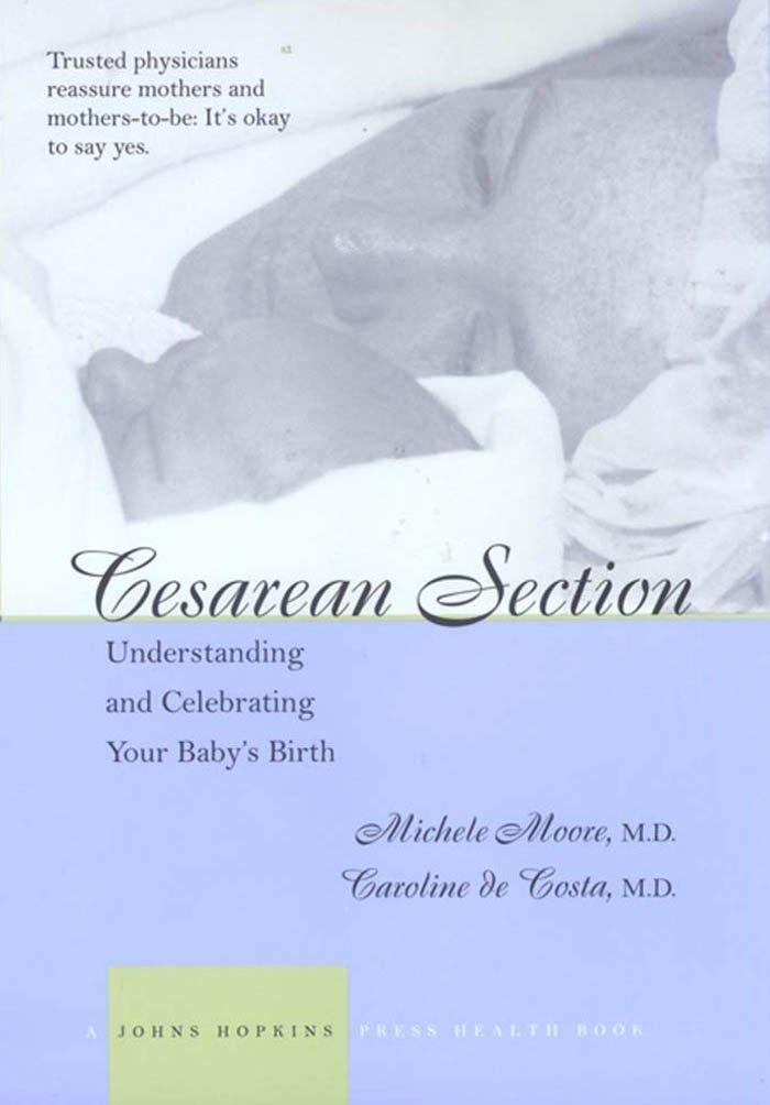 Cesarean Section: Understanding and Celebrating Your Baby's Birth - FULL INSTANT DOWNLOAD | PDF DOCX EPUB