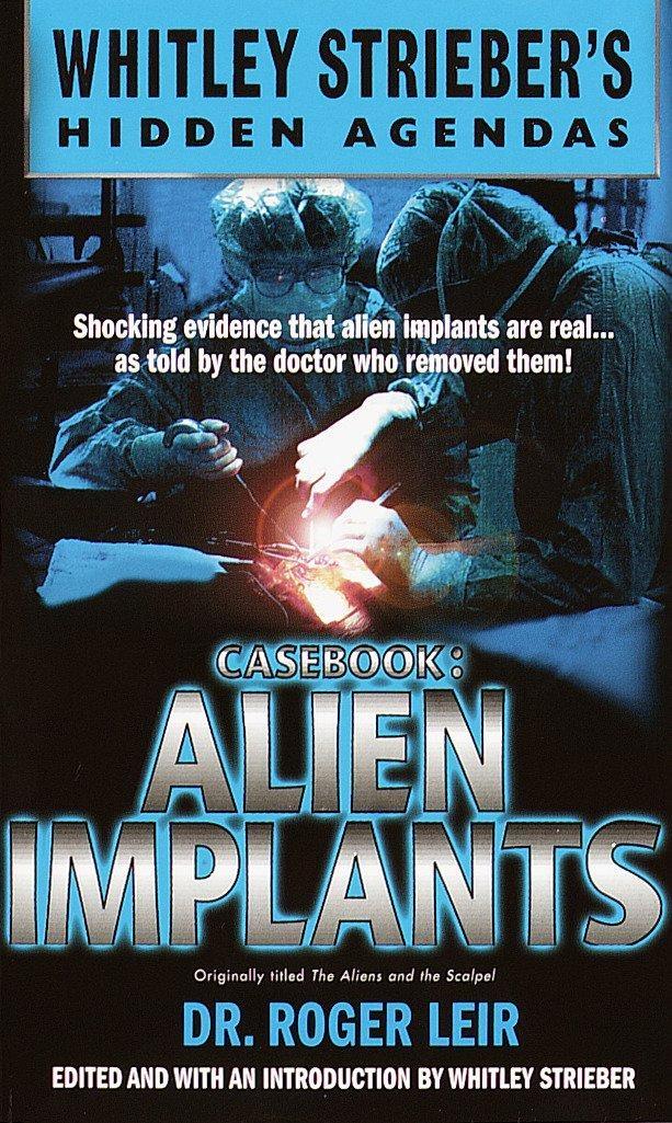 Casebook: Alien Implants - FULL INSTANT DOWNLOAD | PDF DOCX EPUB