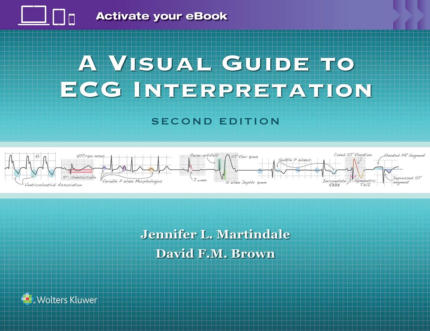 A Visual Guide to ECG Interpretation, 2nd Edition - FULL INSTANT DOWNLOAD | PDF DOCX EPUB
