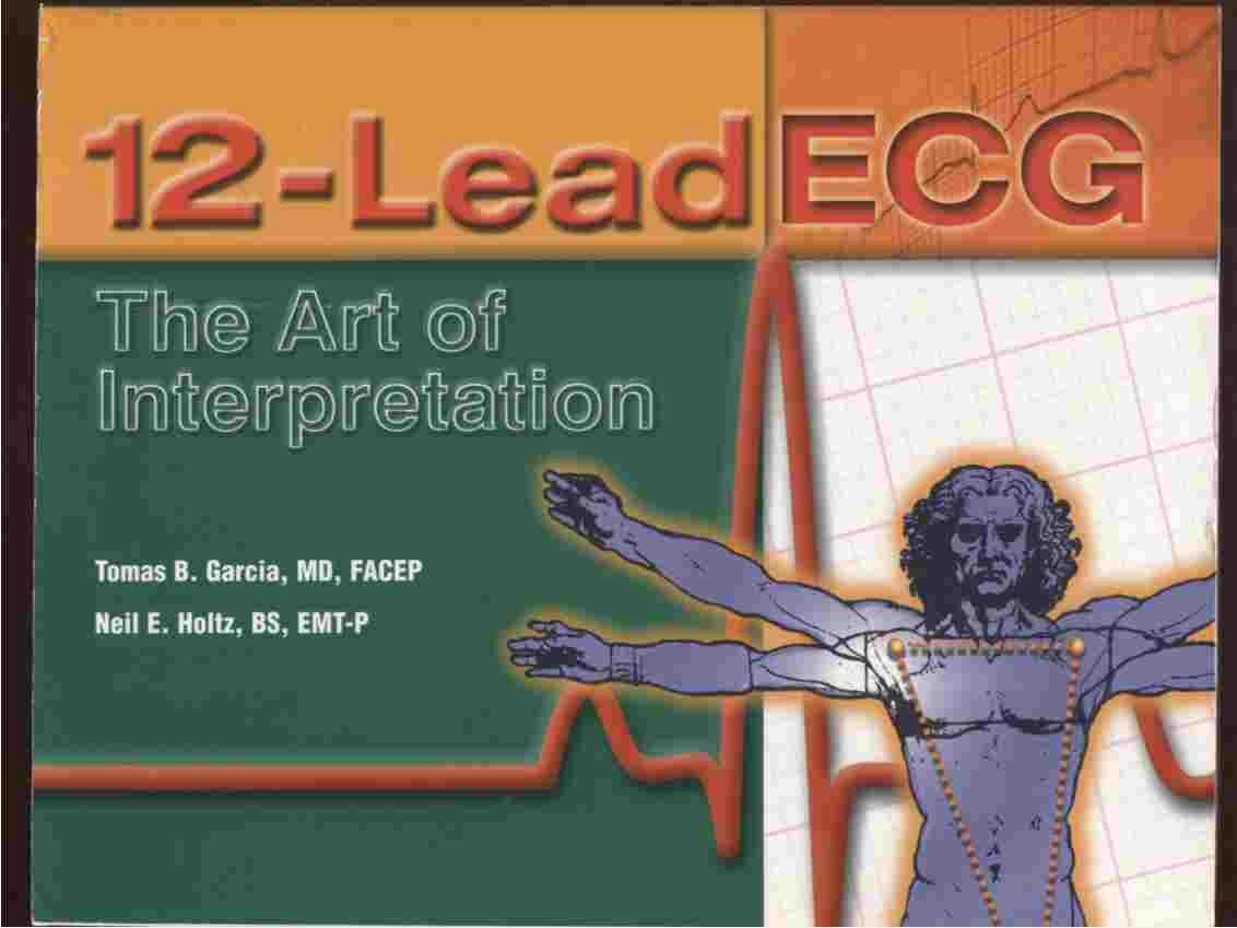 12-Lead ECG: The Art of Interpretation - FULL INSTANT DOWNLOAD | PDF DOCX EPUB