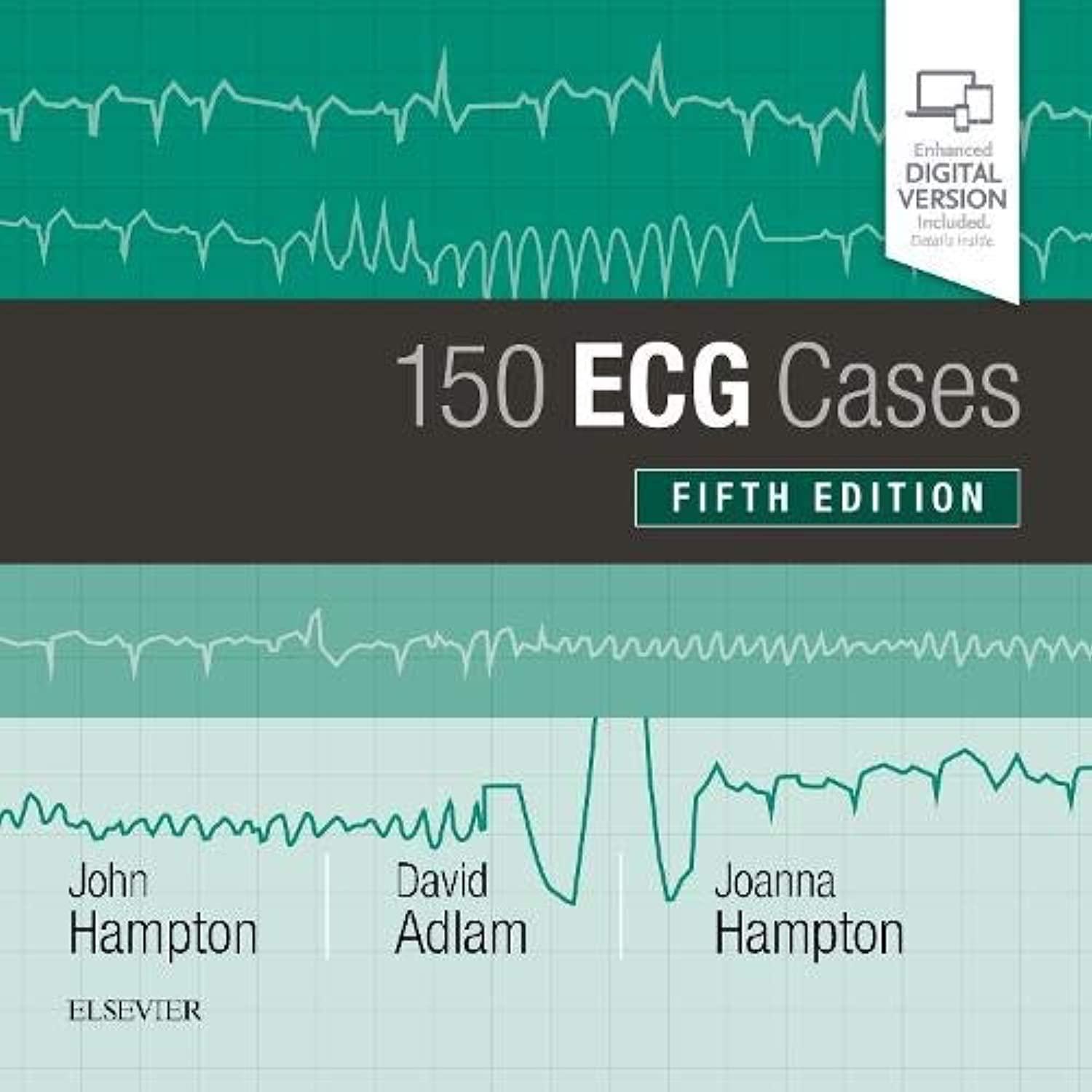150 ECG Cases - FULL INSTANT DOWNLOAD | PDF DOCX EPUB
