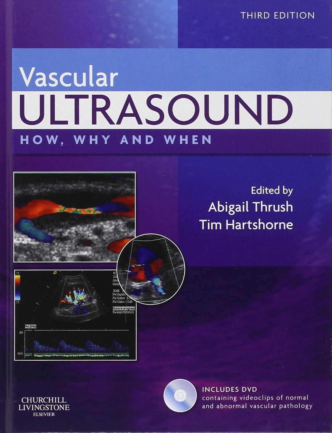 Vascular Ultrasound: How, Why and When - FULL INSTANT DOWNLOAD | PDF DOCX EPUB