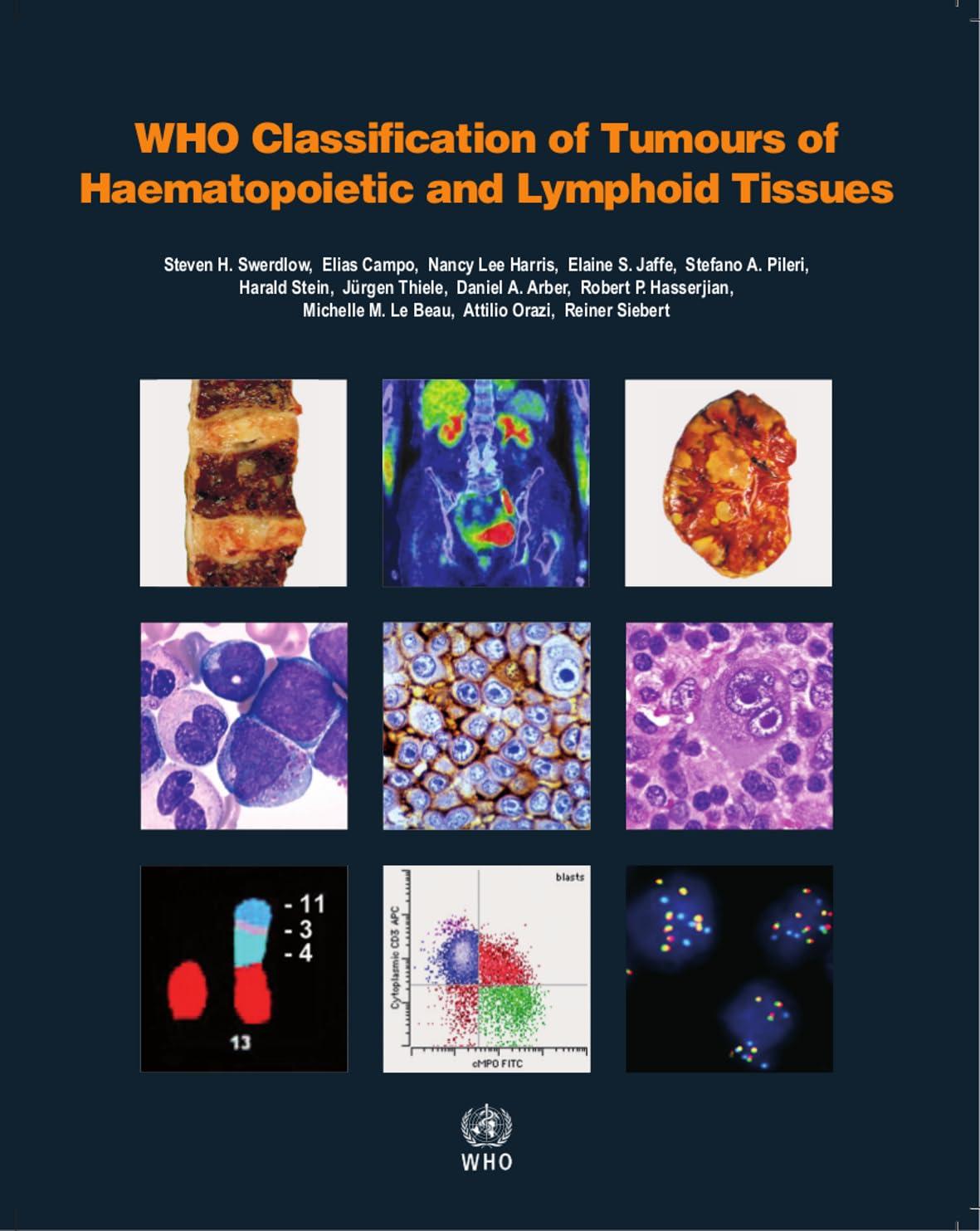 WHO Classification of Tumours of Haematopoietic and Lymphoid Tissues - FULL INSTANT DOWNLOAD | PDF DOCX EPUB