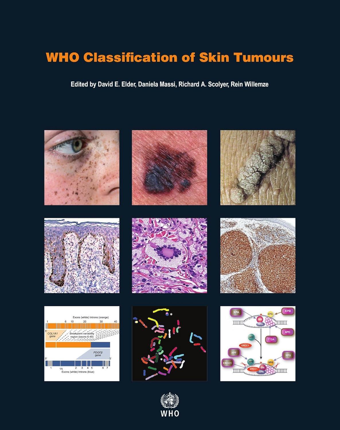 WHO Classification of Skin Tumours (WHO Classification of Tumours) - FULL INSTANT DOWNLOAD | PDF DOCX EPUB
