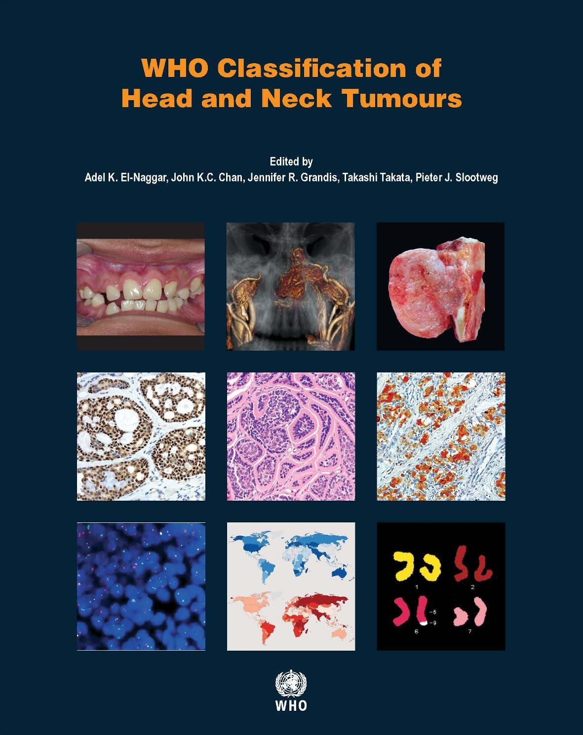 WHO Classification of Head and Neck Tumours [OP] (WHO Classification of Tumours) - FULL INSTANT DOWNLOAD | PDF DOCX EPUB