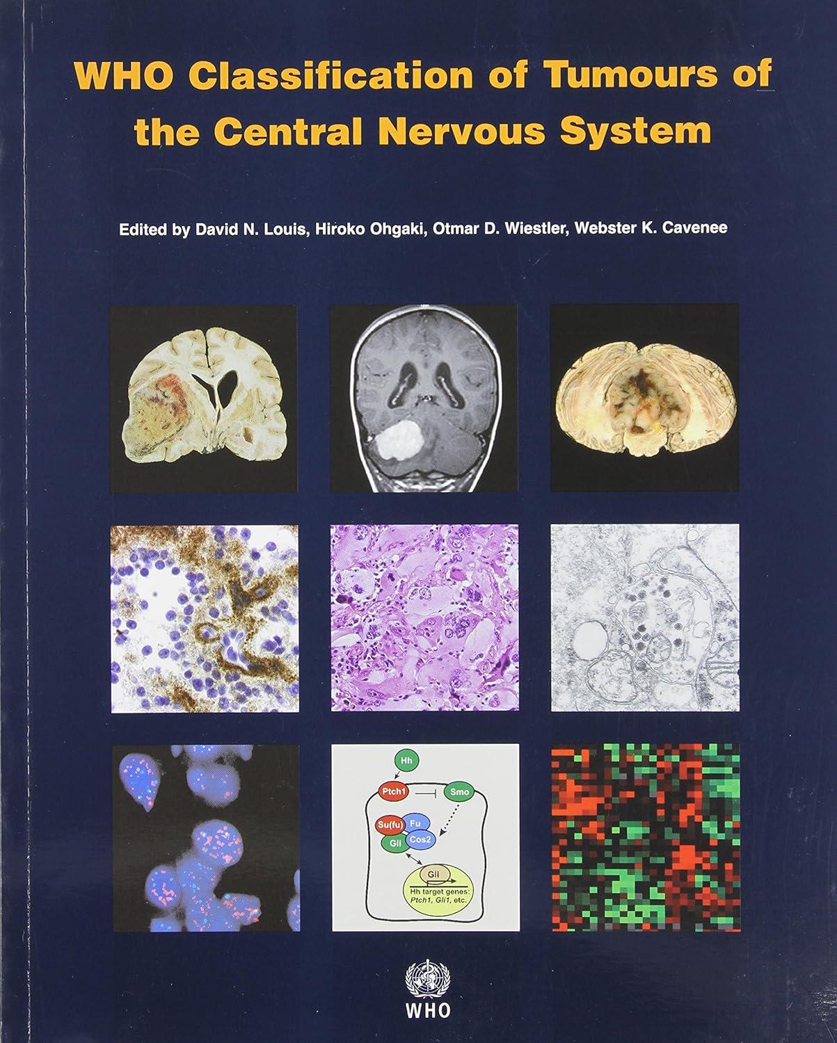 WHO Classification of Tumours of the Central Nervous System (IARC WHO Classification of Tumours) - FULL INSTANT DOWNLOAD | PDF DOCX EPUB